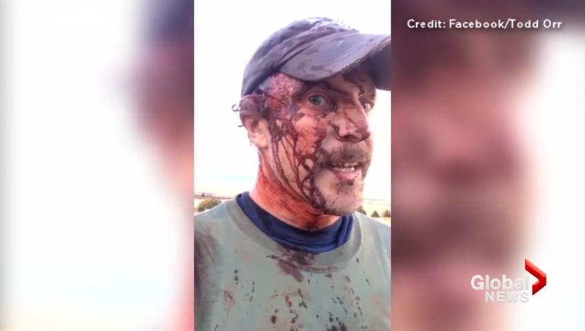 Man Shares Dramatic Video After Surviving Two Grizzly Bear Attacks Watch News Videos Online Man Shares Dramatic Video After Surviving Two Grizzly Bear Attacks Watch News Videos Online