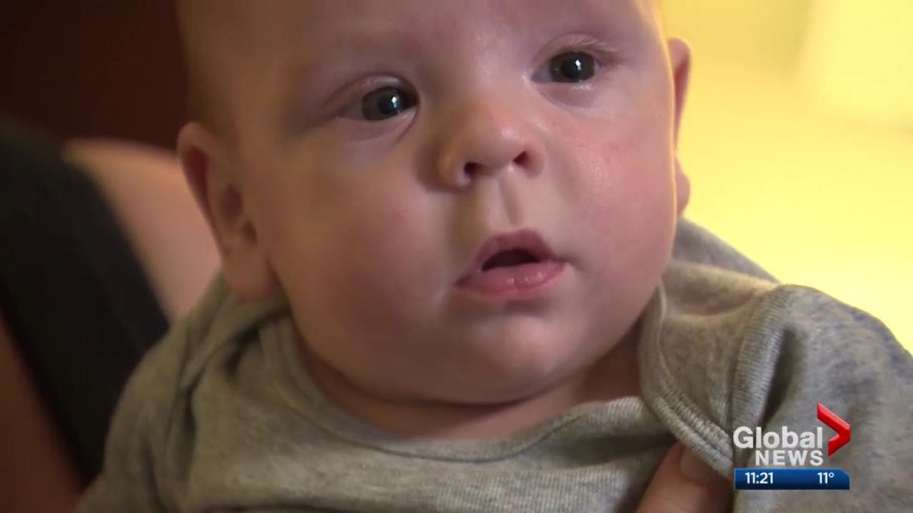 Premature Edmonton Baby Weighed Just Over 1 Pound At Birth Watch News Videos Online Premature Edmonton Baby Weighed Just Over 1 Pound At Birth Watch News Videos Online